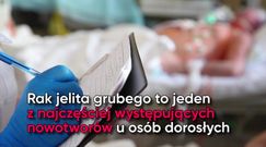 Rak jelita grubego. Jakie są jego czynniki ryzyka?