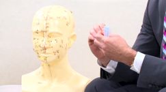 Czy akupunktura przyniesie ulgę przy bólach głowy?