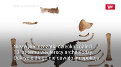 Zagadka zmumifikowanej rączki. Pierwszy taki przypadek w historii