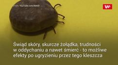 Wyjątkowy gatunek kleszcza. Powoduje alergię na mięso