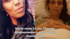 Hictoria walki z rakiem wątroby - Nicole Yarran