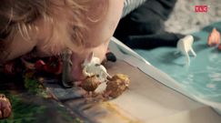 Zaczęło się od niebieskiej plamki na nosie. Dziecku amputowano kończyny