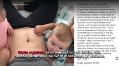 Szczere wyznanie matki. Pokazała, jak naprawdę wygląda ciało po cesarce 