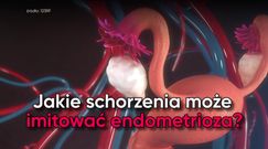 Jakie schorzenia może imitować endometrioza?