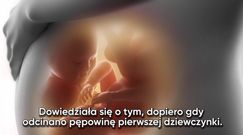 Bliźnięta, które urodziły się w różnych krajach