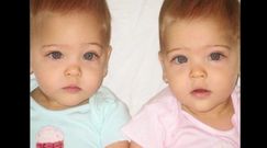 Gdy się urodziły, nazwano je najpiękniejszymi. Tak wyglądają po 8 latach