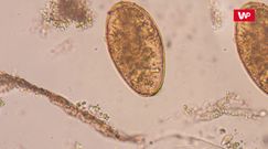 17 osób dało się zarazić pasożytem. Pomagają opracować szczepionkę