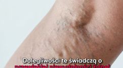 Objawy chorego serca widoczne na skórze