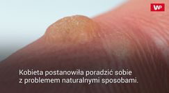 Kobieta przyłożyła do skóry plaster z rozgniecionym czosnkiem. Zobacz, co się stało