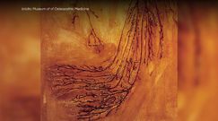 Prawie 100 lat temu wypreparowali cały ludzki układ nerwowy