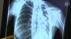 Choruje na gruźlicę i nie chce się leczyć. Za to trafi do więzienia