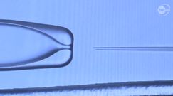 Władze Łodzi dofinansują in vitro: "Będziemy ponosić 50 procent kosztów"