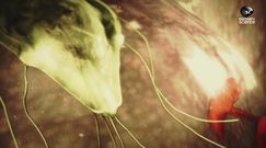 Nieprzyjemna pamiątka z podróży poślubnej