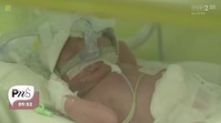 Urodziła bliźniaczki w 33. tygodniu ciąży. Przeżyły dzięki tym lekarzom