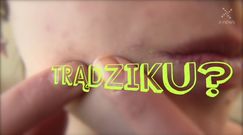 Te produkty pomogą pozbyć się trądziku