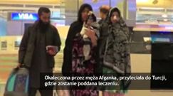 Obciął jej nos, bo wyszła z domu bez jego zgody