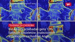 Tajemnicza choroba znaleziona w szkieletach