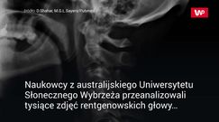 Korzystanie z komórki zmienia nasz szkielet. Najnowsze doniesienia naukowców