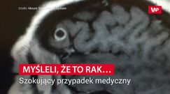 Myśleli, że to rak. Szokujący przypadek medyczny