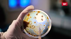 Bruceloza na czarnej liście CDC