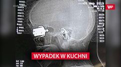 Wypadek w kuchni