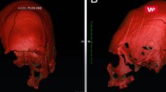 Makabryczne odkrycie. Ich czaszki jasno wskazują, kim byli