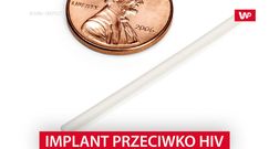 Implant przeciwko HIV