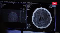 Boska proporcja ludzkiego mózgu. Niesamowite odkrycie naukowców