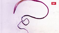 Trzy płciowy robak. Naukowcy przecierali oczy ze zdumienia