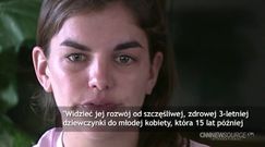 Dziewczynka zmarła po wizycie u dentysty