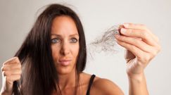 Łysienie plackowate [Wirtualna Poradnia]