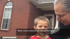 Nietypowy sposób wyrywania zęba