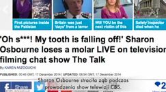 Sharon Osbourne wypadł ząb w programie na żywo