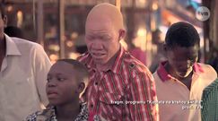 Polowanie na albinosów w Tanzanii