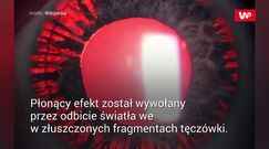 Okulista zbadał oko. Od razu wysłał pacjenta na operację