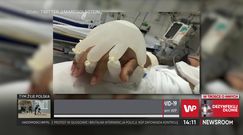 Prof. Rejdak o pacjentach umierających w samotności na COVID-19