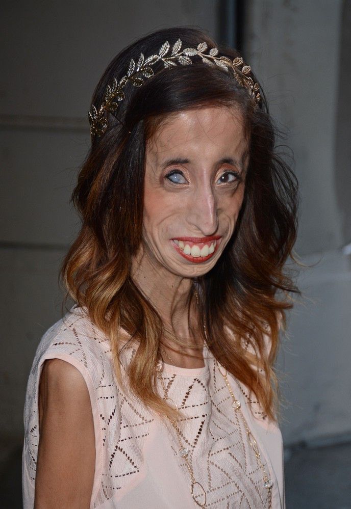 Lizzie Velasquez: kiedyś nazywana "najbrzydszą kobietą świata", dziś jest przykładem dla milionów ofiar cyberprzemocy