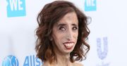 Lizzie Velasquez pokazała zdjęcie z przeszłości. Zwróciła uwagę na swój makijaż