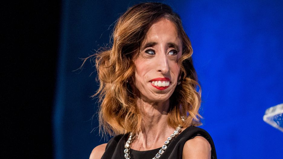 Lizzie Velasquez nie traci pozytywnego nastawienia do życia