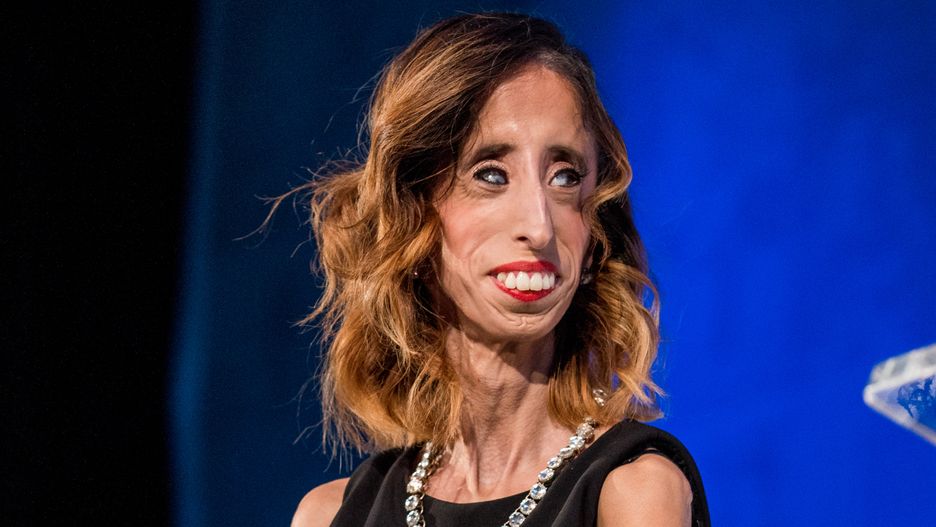Lizzie Velasquez  ma ważne przesłanie do wszystkich