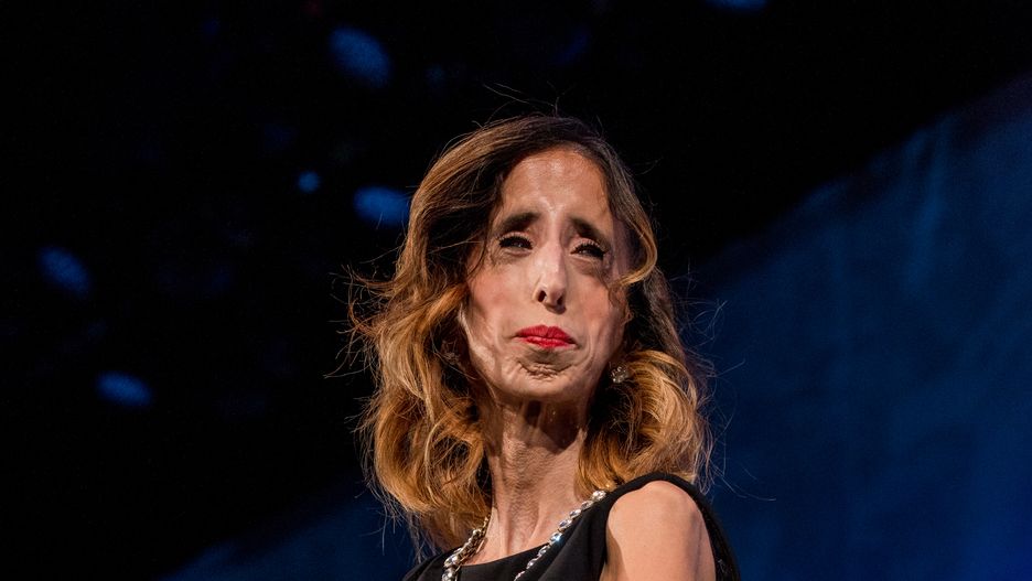 Lizzie Velasquez cierpi na rzadką chorobę