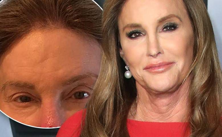 Masakra! Caitlyn Jenner straszy na Instagramie! Z jej twarzą stało się coś bardzo niedobrego