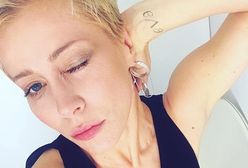 Katarzyna Warnke jest całkiem łysa. Opublikowała nowe zdjęcie