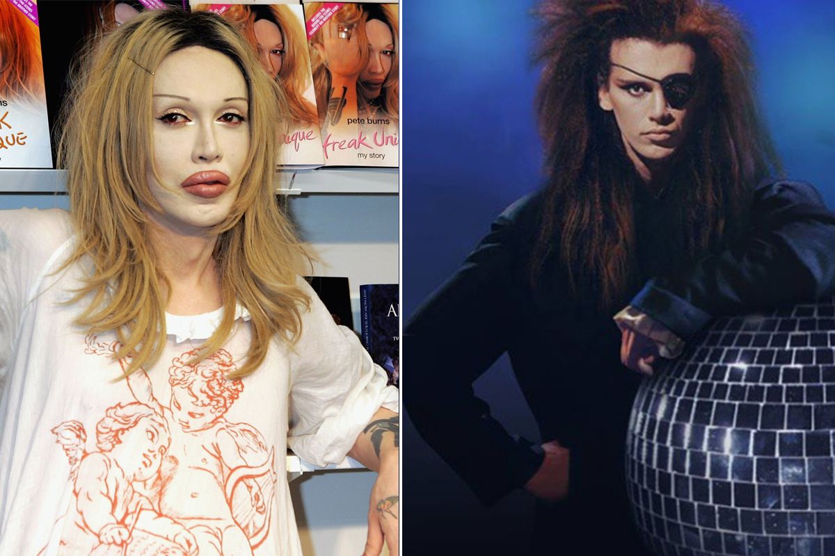 Przeszedł 300 operacji plastycznych. Tak go zmieniły