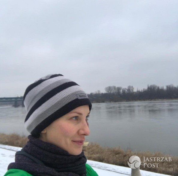 Joanna Moro z podbitym okiem