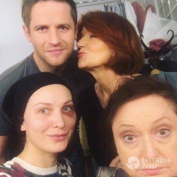 Joanna Moro z podbitym okiem