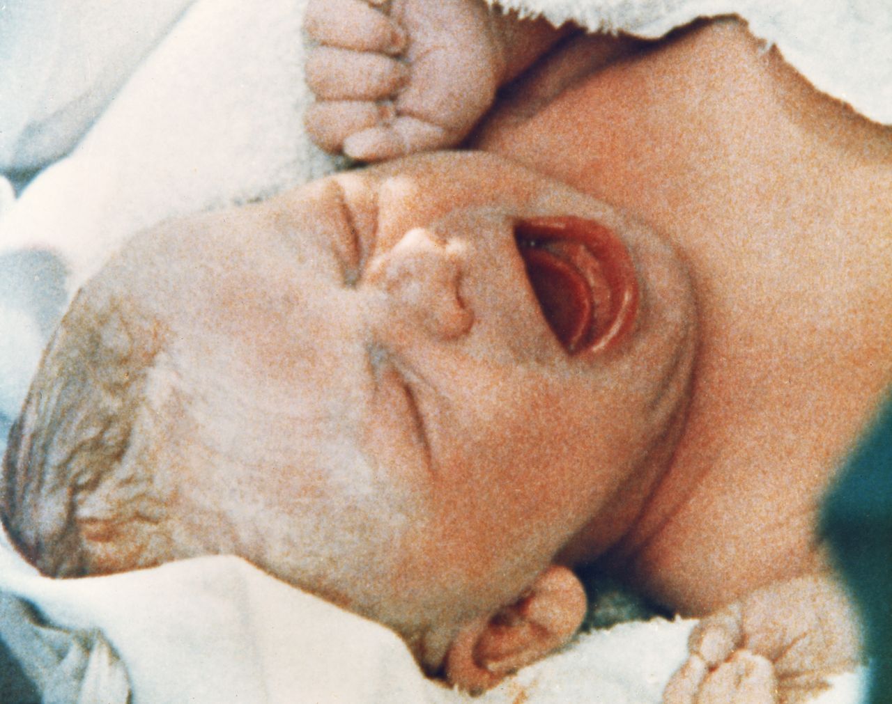 Louise Brown jest pierwszą osobą na świecie, która urodziła się dzięki in vitro. Ma już 40 lat