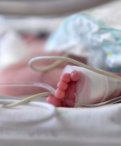 Niemcy. Trzy zdeformowane noworodki z identyczną wadą. Ekspert mówi o możliwych przyczynach