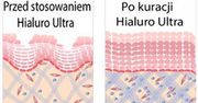 Już 6 mln Polek usunęło zmarszczki! Jak zrobić to w domu? Wywiad z lekarzem