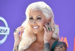 Amber Rose poszła na operacje plastyczne. 6 tygodni po porodzie